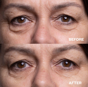 Wrinkle Schminkles Eye Silicon Patches